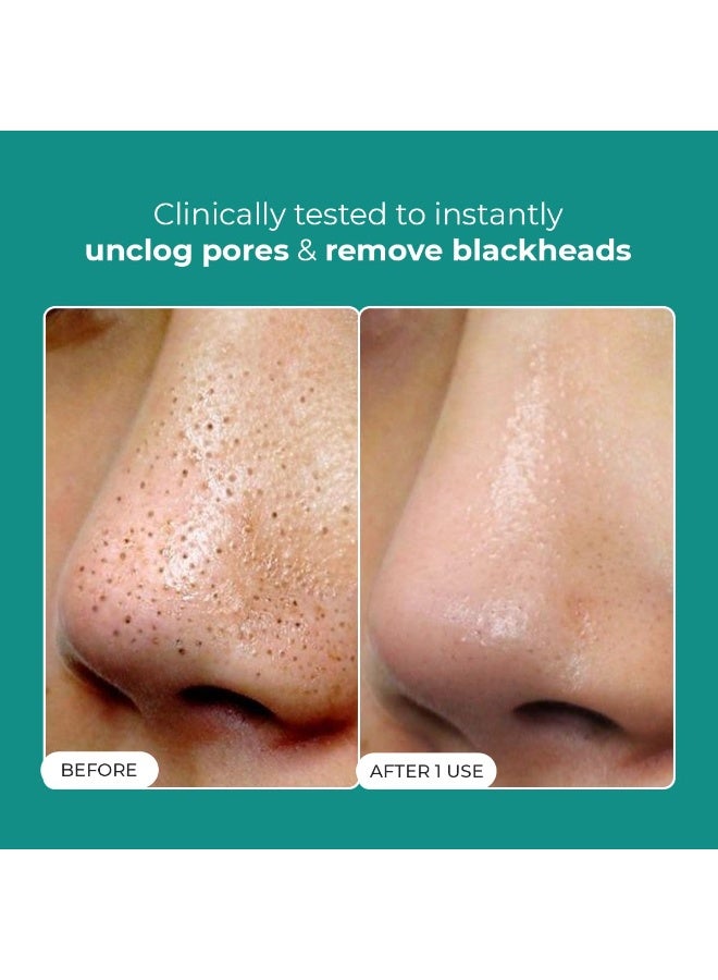 كيميائي واعي ماء إزالة الرؤوس السوداء من كونشيس كيميست® | 50 مل | علاج لطيف للمسام بحمض السكسينيك وحمض الجليكوليك وإكسوسومات السيكا | يفتح المسام، ويزيل الرؤوس السوداء، وينعم البشرة | تونر للرجال والنساء - Image 2